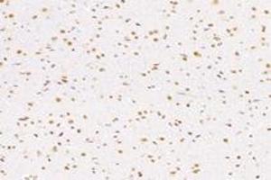 Immunohistochemistry analysis of paraffin-embedded rat substantia nigra using NUP133 (ABIN7074909) at dilution of 1: 4800