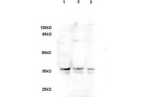 Sheep fat cell lysate 30ug, probed with Rabbit Anti-DLK1/DLL1 Polyclonal Antibody (ABIN740055) at 1:200 overnight in 4 °C.