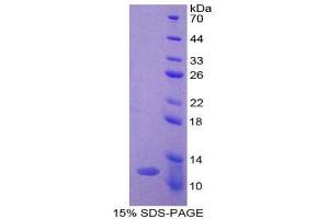 SDS-PAGE (SDS) image for Ghrelin (GHRL) (AA 25-117) protein (His tag) (ABIN1980876)