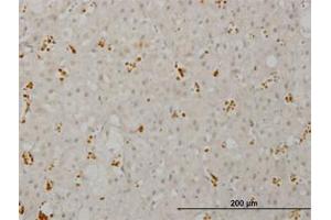 Image no. 1 for anti-pi-3-Kinase-Related Kinase SMG-1 (SMG1) (AA 2922-3032) antibody (ABIN599192) (SMG1 anticorps  (AA 2922-3032))