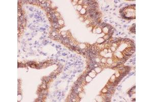 IHC-P staining of rat intestine tissue (CTNNA1 anticorps  (AA 143-292))