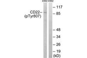 Western blot analysis of extracts from K562 cells treated with Na3VO4 0. (CD22 anticorps  (pTyr807))
