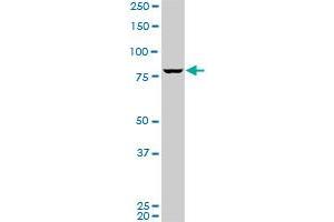SP1 monoclonal antibody (M09), clone 3H7.