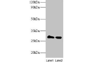 Western blot All lanes: TPMT antibody at 2 μg/mL Lane 1: EC109 whole cell lysate Lane 2: 293T whole cell lysate Secondary Goat polyclonal to rabbit IgG at 1/15000 dilution Predicted band size: 29 kDa Observed band size: 29 kDa (TPMT anticorps  (AA 4-244))