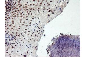 Image no. 9 for anti-Protein Phosphatase 1, Regulatory (Inhibitor) Subunit 15A (PPP1R15A) antibody (ABIN1498364)