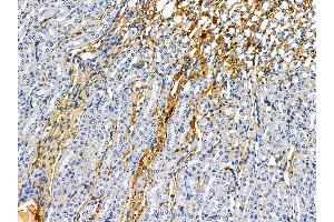 anti-EF-Hand Domain Family, Member A1 (EFHA1) antibody