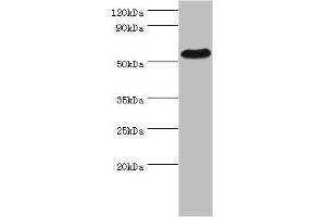 Western blot All lanes: PSEN1 antibody at 2 μg/mL + Hela whole cell lysate Secondary Goat polyclonal to rabbit IgG at 1/10000 dilution Predicted band size: 53, 43, 22, 47, 49 kDa Observed band size: 53 kDa (Presenilin 1 anticorps  (AA 1-160))