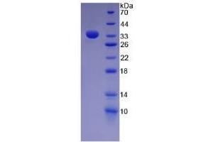 SDS-PAGE of Protein Standard from the Kit (Highly purified E. (Fibronectin Kit CLIA)