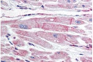 Human Heart (formalin-fixed, paraffin-embedded) stained with BIRC7 antibody ABIN298022 at 10 ug/ml followed by biotinylated anti-mouse IgG secondary antibody ABIN481714, alkaline phosphatase-streptavidin and chromogen. (BIRC7 anticorps)