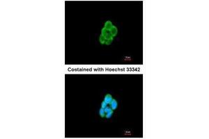 ICC/IF Image Immunofluorescence analysis of methanol-fixed A431, using CMTM6, antibody at 1:200 dilution. (CMTM6 anticorps  (C-Term))