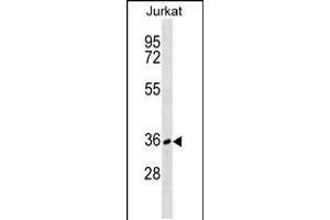 Western blot analysis in Jurkat cell line lysates (35ug/lane).