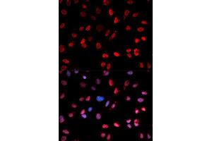 Immunofluorescence analysis of MCF-7 cells using Phospho-ATF2-T71 antibody (ABIN5969881). (ATF2 anticorps  (pThr53))