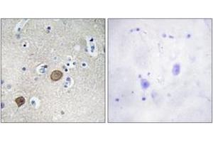 Immunohistochemistry analysis of paraffin-embedded human brain tissue, using Catenin-alpha1 (Ab-641) Antibody. (CTNNA1 anticorps  (AA 607-656))