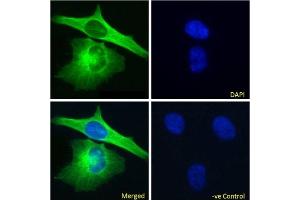 Immunofluoresence staining of fixed HeLa cells with anti-Alpha-tubulin antibody F2C.
