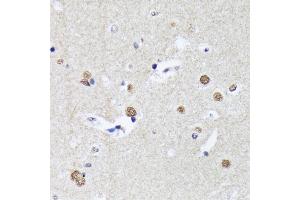 Immunohistochemistry of paraffin-embedded human brain using Matrin 3 Rabbit mAb (ABIN7268414) at dilution of 1:100 (40x lens).