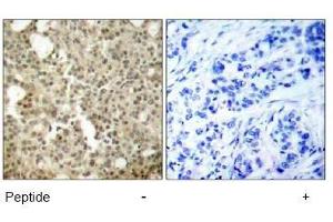 Image no. 1 for anti-Protein Kinase C, delta (PKCd) (AA 643-647) antibody (ABIN197564) (PKC delta anticorps  (AA 643-647))