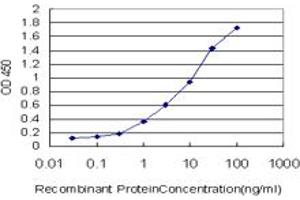 Detection limit for recombinant GST tagged DPYD is approximately 0.