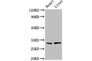 Western Blot Positive WB detected in: Mouse heart tissue, Rat liver tissue All lanes: SDCBP antibody at 3 μg/mL Secondary Goat polyclonal to rabbit IgG at 1/50000 dilution Predicted band size: 33, 32 kDa Observed band size: 33 kDa (SDCBP anticorps  (AA 21-228))