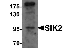 Western blot analysis of SIK2 in SW480 cell lysate with SIK2 antibody at 1 µg/mL.