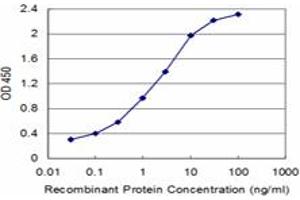 anti-Spastin (SPAST) (AA 200-304) antibody