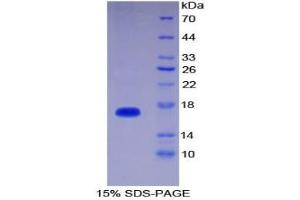 SDS-PAGE analysis of Human Interleukin 1 delta Protein. (FIL1d Protéine)