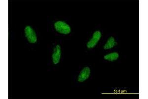 Immunofluorescence of purified MaxPab antibody to ZFP28 on HepG2 cell.