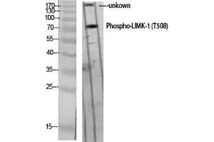Western Blot (WB) analysis of specific cells using Phospho-LIMK-1 (T508) Polyclonal Antibody.