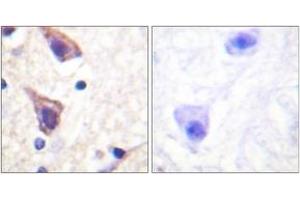 Immunohistochemistry analysis of paraffin-embedded human brain tissue, using TGF beta Receptor II (Ab-250) Antibody. (TGFBR2 anticorps  (AA 191-240))