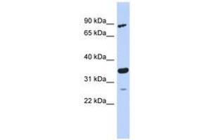 Image no. 1 for anti-PDLIM1 Interacting Kinase 1 Like (PDIK1L) (AA 179-228) antibody (ABIN6743713) (PDIK1L anticorps  (AA 179-228))