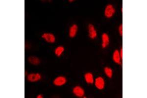 Immunofluorescent analysis of VDR staining in HeLa cells. (Vitamin D Receptor anticorps  (Center))
