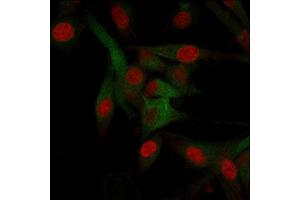 Immunofluorescence staining of U87MG cells using CD68 Mouse Monoclonal Antibody (C68/684) followed by goat anti-Mouse IgG conjugated to CF488 (green).