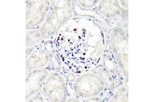 Immunohistochemistry of paraffin-embedded rat kidney using WT1 Rabbit mAb  at dilution of 1:100 (40x lens). (WT1 anticorps)