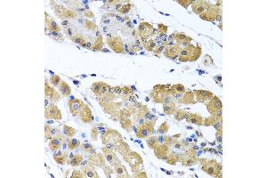 Immunohistochemistry of paraffin-embedded human stomach using OGFR antibody (ABIN6128395, ABIN6145006, ABIN6145007 and ABIN6222871) at dilution of 1:100 (40x lens). (OGFR anticorps  (AA 1-280))