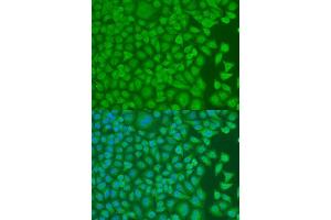 Immunofluorescence analysis of U2OS cells using PCBP1 antibody. (PCBP1 anticorps  (AA 100-200))