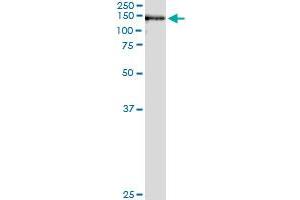 Immunoprecipitation of USP33 transfected lysate using anti-USP33 monoclonal antibody and Protein A Magnetic Bead , and immunoblotted with USP33 MaxPab rabbit polyclonal antibody.