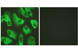 Immunofluorescence analysis of HeLa cells, using Kir5. (KIR5.1 anticorps  (Ser416))