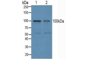 Western blot analysis of (1) Human Jurkat Cells and (2) Human K562 Cells. (ube3a anticorps  (AA 158-407))