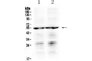 Western blot analysis of PTGER4 using anti- PTGER4 antibody . (PTGER4 anticorps  (C-Term))