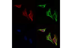 ABIN6258206 and ABIN6274351 staining Hela cells by IF/ICC. (GIT2 anticorps  (Internal Region))