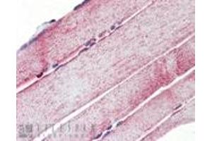 Immunohistochemistry analysis of human skeletal muscle tissue stained with Mn SOD, pAb at 10 μg/mL. (SOD2 anticorps)