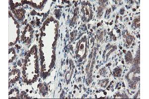 Immunohistochemical staining of paraffin-embedded Human breast tissue using anti-ACBD3 mouse monoclonal antibody. (ACBD3 anticorps)