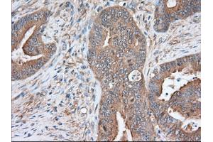 Immunohistochemical staining of paraffin-embedded Human prostate tissue using anti-SNX9 mouse monoclonal antibody. (SNX9 anticorps)