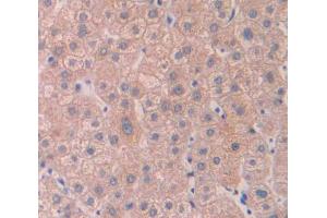 Used in DAB staining on fromalin fixed paraffin- embedded Kidney tissue