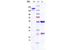 Anti-ICAM1 / CD54 Reference Antibody (bersanlimab) on SDS-PAGE under reducing (R) condition. (Recombinant ICAM1 (Bersanlimab Biosimilar) anticorps)