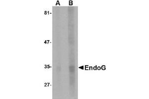 Western Blotting (WB) image for anti-Endonuclease G (ENDOG) (AA 51-140) antibody (ABIN492523) (Endonuclease G anticorps  (AA 51-140))