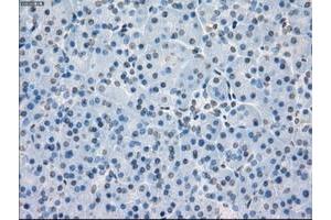 Image no. 7 for anti-Protein Phosphatase 5, Catalytic Subunit (PPP5C) antibody (ABIN1500390)