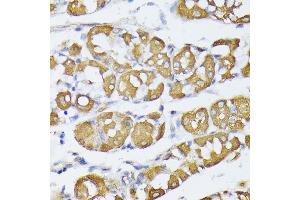Immunohistochemistry of paraffin-embedded human stomach using VAPA antibody (ABIN6132892, ABIN6150056, ABIN6150057 and ABIN6216758) at dilution of 1:100 (40x lens). (VAPA anticorps  (AA 137-227))