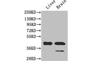 Western Blot Positive WB detected in: Mouse liver tissue, Mouse brain tissue All lanes: GLUL antibody at 3 μg/mL Secondary Goat polyclonal to rabbit IgG at 1/50000 dilution Predicted band size: 42 kDa Observed band size: 42 kDa (GLUL anticorps  (AA 86-373))