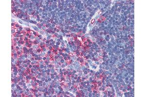 Anti-MSN / Moesin antibody IHC of human thymus.