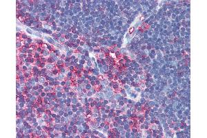 Anti-MSN / Moesin antibody IHC of human thymus. (Moesin anticorps)